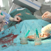 Операция с использованием высокотехнологичного оборудования и аппаратуры в Клинике № 1 ВолгГМУ