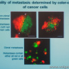 Прижизненная окраска метастазирующих клеток